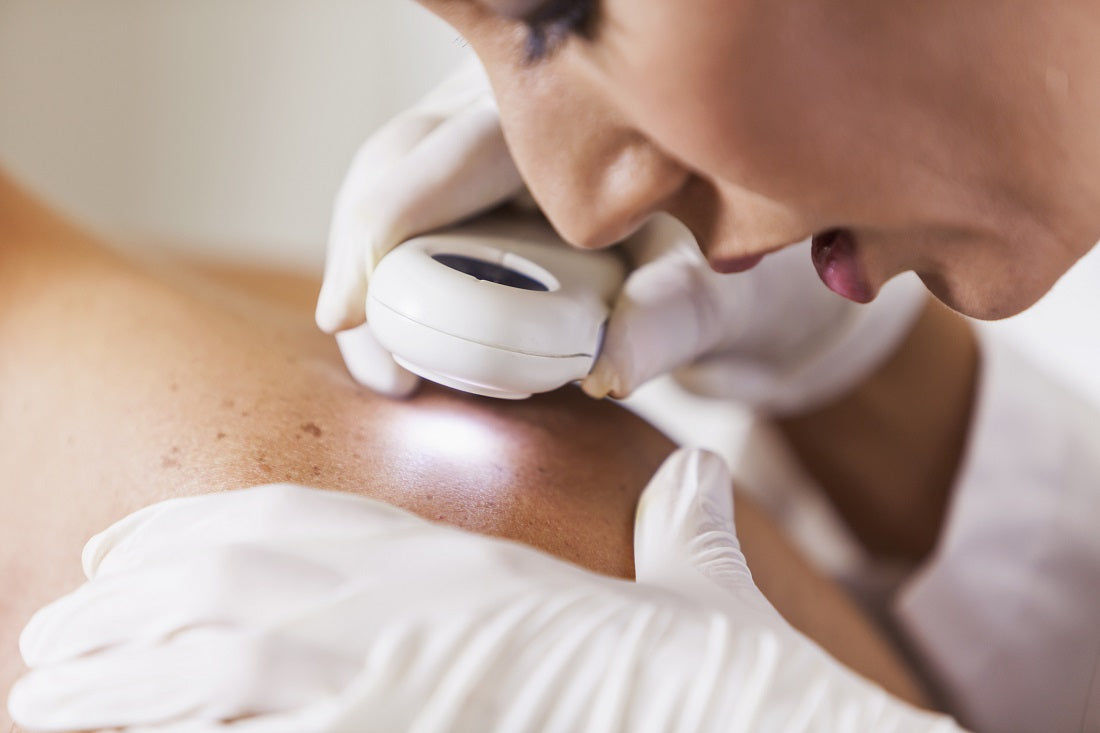 Why is skin cancer more likely after an organ transplant?