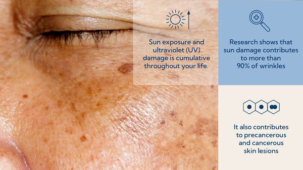 Can skin damage caused by the sun be repaired or even reversed?