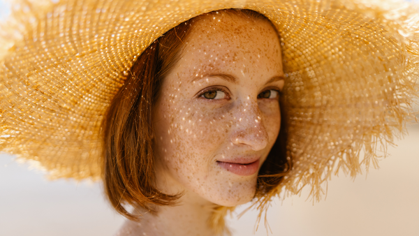 What is photocontact eczema?
