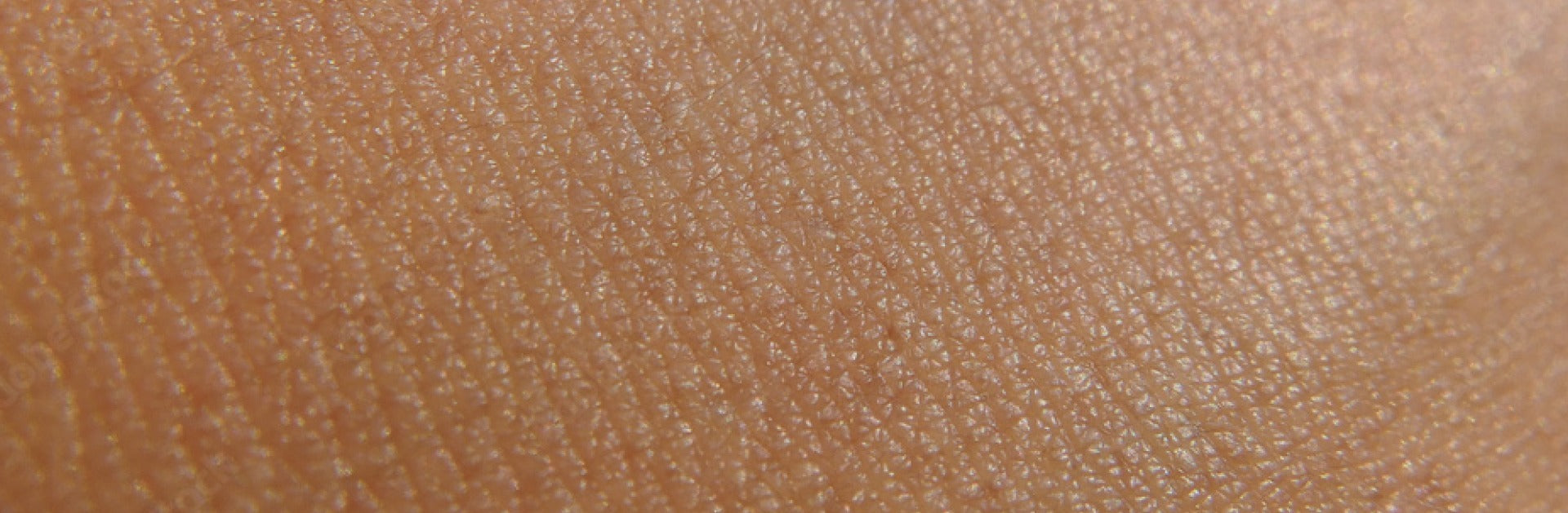 Healthy skin image.